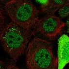Immunofluorescent staining of human cell line A-431 shows localization to nucleoplasm, cytosol & vesicles.