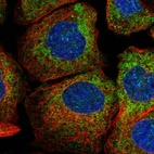 Immunofluorescent staining of human cell line A-431 shows localization to endoplasmic reticulum.