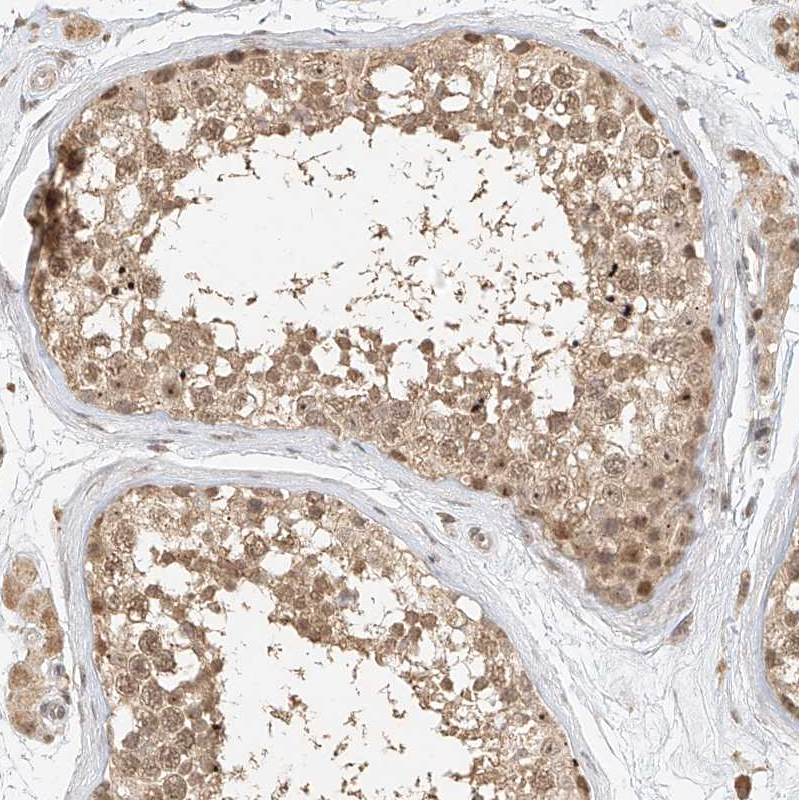 Anti-CXorf58 Antibody