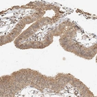 Immunohistochemical staining of human Fallopian tube shows moderate cytoplasmic and nuclear positivity in glandular cells.
