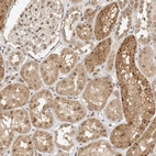 Immunohistochemical staining of human Kidney shows moderate nuclear and cytoplasmic positivity in cells in tubules and glomeruli.