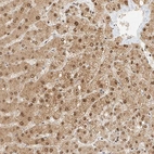 Immunohistochemical staining of human Liver shows moderate nuclear and cytoplasmic positivity in hepatocytes.