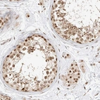 Anti-CXorf58 Antibody