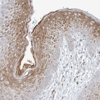 Immunohistochemical staining of human skin shows moderate granular cytoplasmic positivity in squamous epithelial cells.