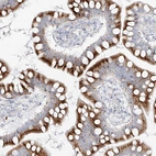 Immunohistochemical staining of human small intestine shows strong granular cytoplasmic positivity in glandular cells.