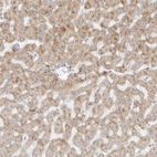 Immunohistochemical staining of human liver shows moderate granular cytoplasmic positivity in hepatocytes.