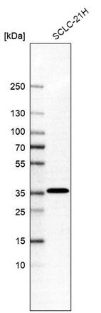 Western blot analysis in human cell line SCLC-21H.