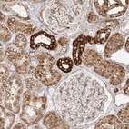 Anti-MTX2 Antibody