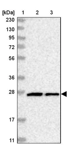 Lane 1: Marker [kDa] 230, 130, 95, 72, 56, 36, 28, 17, 11_br/_Lane 2: Human cell line RT-4_br/_Lane 3: Human cell line U-251MG sp