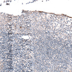 Immunohistochemical staining of human tonsil shows no positivity in lymphoid cells as expected.