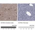 Anti-KCTD8 Antibody