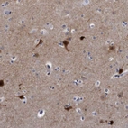 Immunohistochemical staining of human cerebral cortex shows high expression.