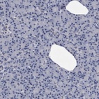 Anti-KCTD8 Antibody