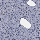 Immunohistochemical staining of human pancreas shows low expression as expected.