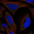 Immunofluorescent staining of human cell line U-2 OS shows localization to vesicles.