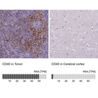 Anti-CD40 Antibody