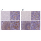 Anti-CD40 Antibody