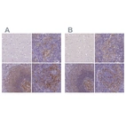 Immunohistochemical staining of human cerebral cortex, lymph node, spleen and tonsil using Anti-CD40 antibody HPA031567 (A) shows similar protein distribution across tissues to independent antibody HPA031568 (B).