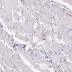 Immunohistochemical staining of human skeletal muscle shows no positivity in myocytes as expected.