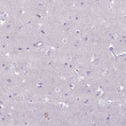 Anti-CD40 Antibody