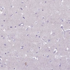 Immunohistochemical staining of human cerebral cortex shows no positivity in neurons as expected.