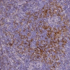 Immunohistochemical staining of human tonsil shows strong membranous positivity in germinal center cells.