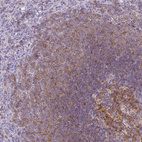 Immunohistochemical staining of human spleen shows moderate membranous positivity in cells in white pulp.
