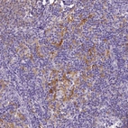 Immunohistochemical staining of human lymph node shows moderate to strong membranous positivity in germinal center cells.