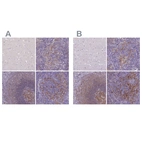 Immunohistochemical staining of human cerebral cortex, lymph node, spleen and tonsil using Anti-CD40 antibody HPA031568 (A) shows similar protein distribution across tissues to independent antibody HPA031567 (B).