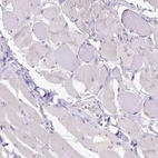 Immunohistochemical staining of human skeletal muscle shows no positivity in myocytes as expected.