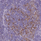 Immunohistochemical staining of human tonsil shows strong membranous positivity in germinal center cells.
