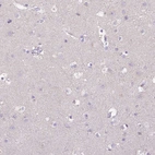 Immunohistochemical staining of human cerebral cortex shows no positivity in neurons as expected.
