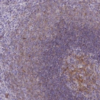 Immunohistochemical staining of human spleen shows moderate membranous positivity in cells in white pulp.