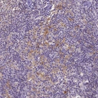 Immunohistochemical staining of human lymph node shows moderate to strong membranous positivity in germinal center cells.