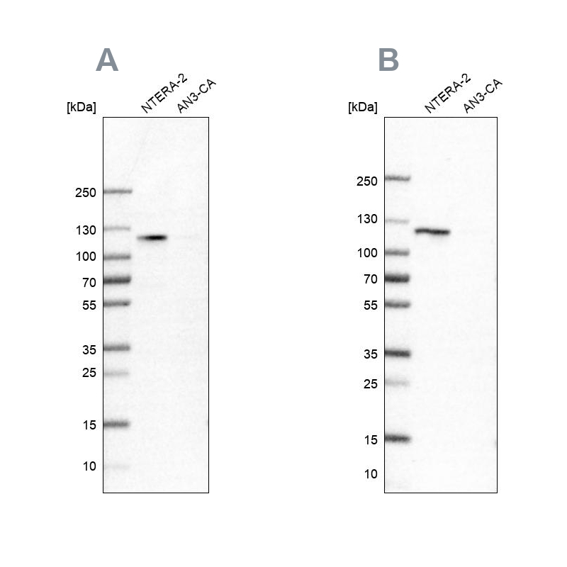 Anti-HSPH1 Antibody