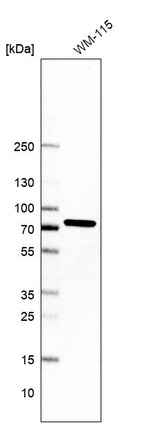 Western blot analysis in human cell line WM-115.