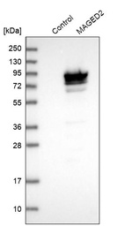 Western blot analysis in control (vector only transfected HEK293T lysate) and MAGED2 over-expression lysate (Co-expressed with a C-terminal myc-DDK tag (~3.1 kDa) in mammalian HEK293T cells, LY415179).