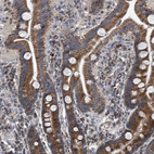 Immunohistochemical staining of human duodenum shows strong granular cytoplasmic positivity in glandular cells.