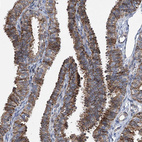 Immunohistochemical staining of human fallopian tube shows strong granular cytoplasmic positivity in glandular cells.