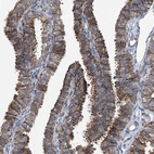 Immunohistochemical staining of human fallopian tube shows strong granular cytoplasmic positivity in glandular cells.