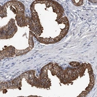 Immunohistochemical staining of human prostate shows strong cytoplasmic positivity in glandular cells.