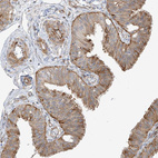 Anti-DCDC2 Antibody