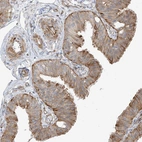 Immunohistochemical staining of human Fallopian tube shows moderate membranous positivity in glandular cells.