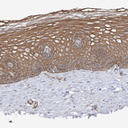 Anti-DCDC2 Antibody