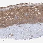 Immunohistochemical staining of human Cervix shows moderate membranous positivity in squamous epithelial cells.