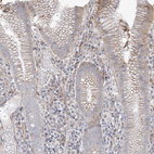 Anti-DCDC2 Antibody