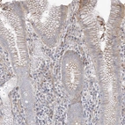 Immunohistochemical staining of human Stomach shows moderate membranous positivity in glandular cells.