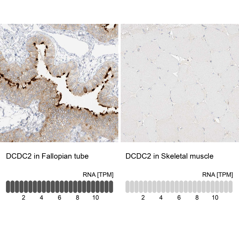 Anti-DCDC2 Antibody