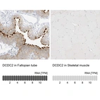 Anti-DCDC2 Antibody