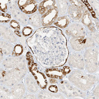 Immunohistochemical staining of human kidney shows strong cytoplasmic positivity in Bowman's capsule and cells in distal tubules.